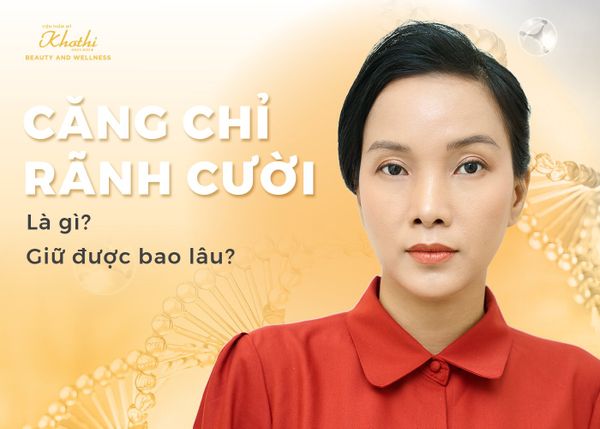 Căng Chỉ Rãnh Cười Là Gì? Căng Chỉ Rãnh Cười Giữ Được Bao Lâu?
