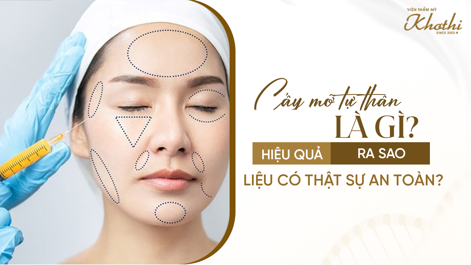 Cấy mỡ tự thân là gì? Hiệu quả làm đẹp ra sao? Liệu có thật sự an toàn?