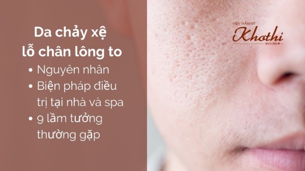 Da chảy xệ lỗ chân lông to: Nguyên nhân và giải pháp