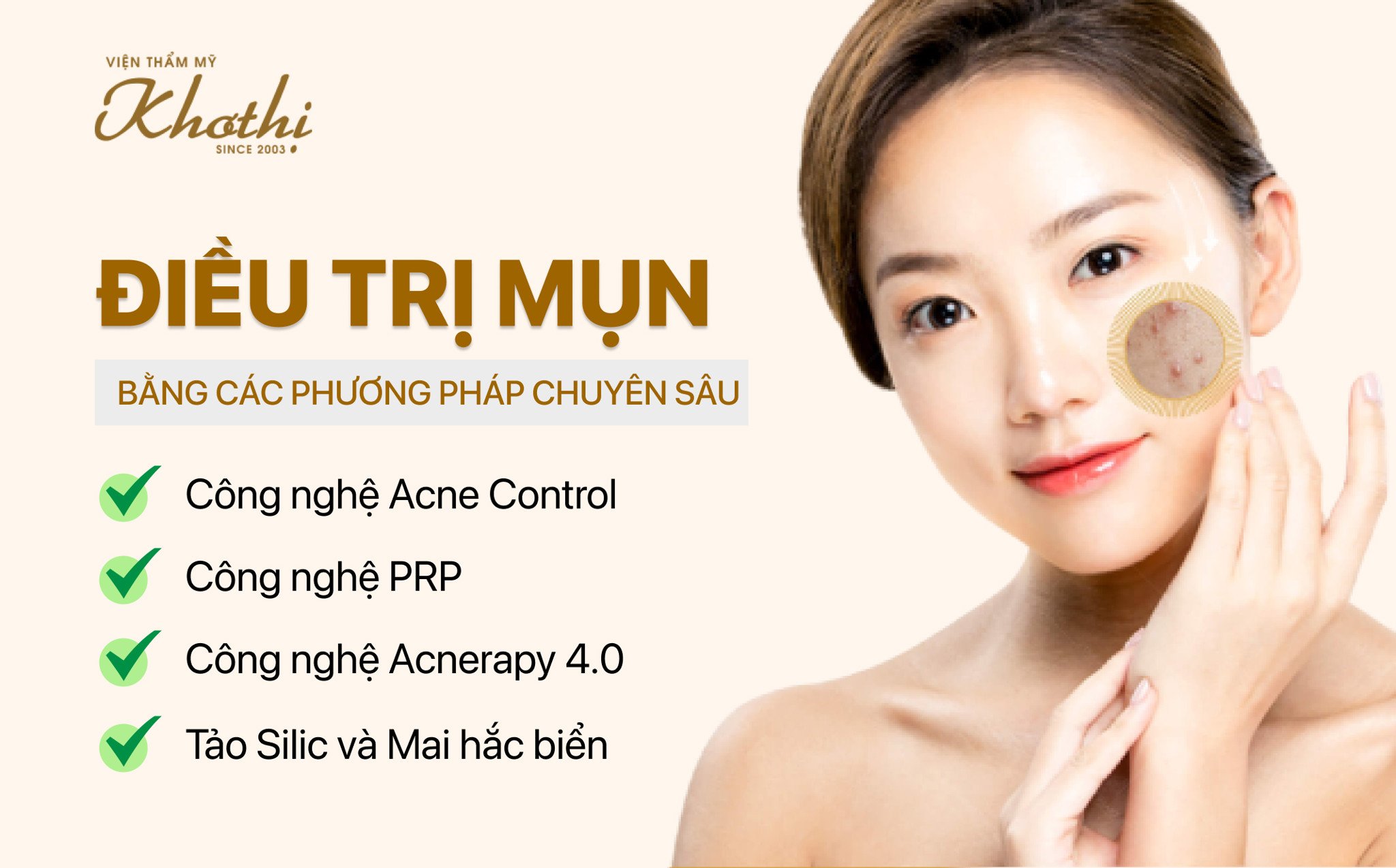 Các phương pháp điều trị mụn đạt hiệu quả cao nhất – Chuyên gia khuyên dùng