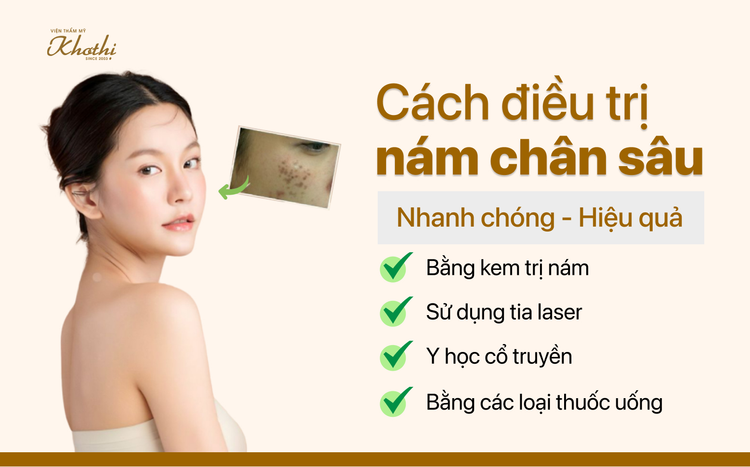 Cách điều trị nám chân sâu nhanh chóng, hiệu quả