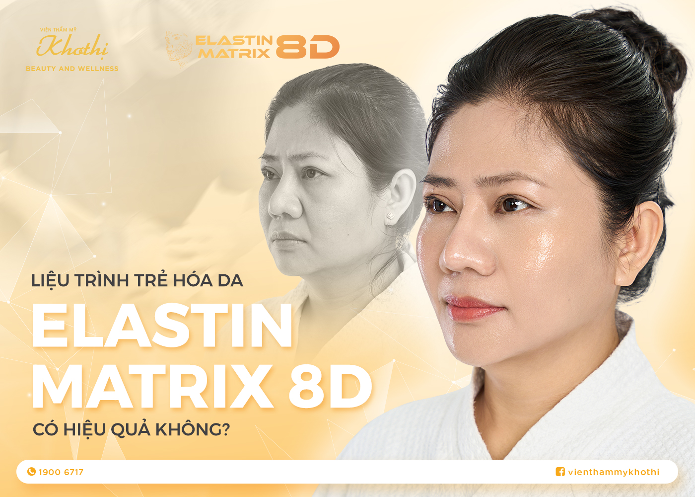 Liệu Trình Trẻ Hóa Da Elastin Matrix 8D Có Hiệu Quả Không?