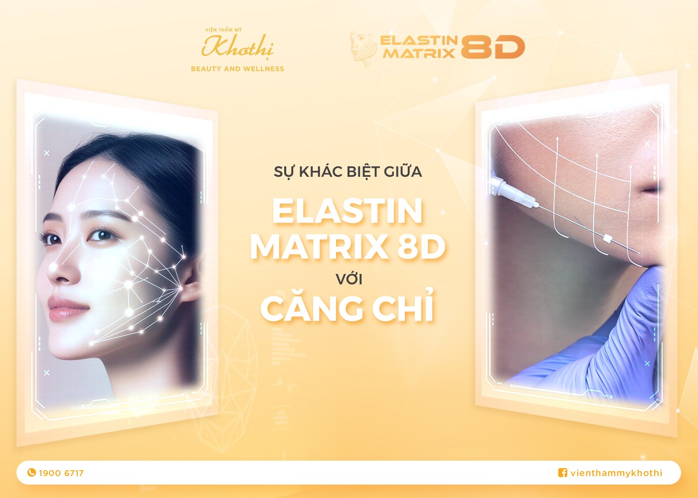 Khác Biệt Về Hiệu Quả Giữa Elastin Matrix 8D Và Căng Chỉ