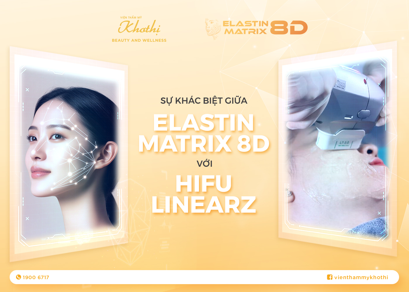 So Sánh Elastin Matrix 8D Với HIFU Chi Tiết Nhất