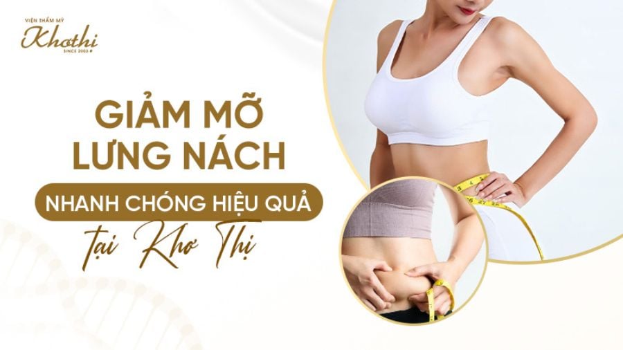 Giảm mỡ lưng nách công nghệ cao nhanh chóng hiệu quả an toàn tuyệt đối tại Khơ Thị