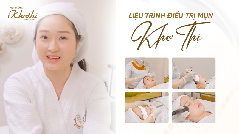 Liệu trình điều trị mụn Khơ Thị nhanh chóng, hiệu quả dứt điểm không tái lại