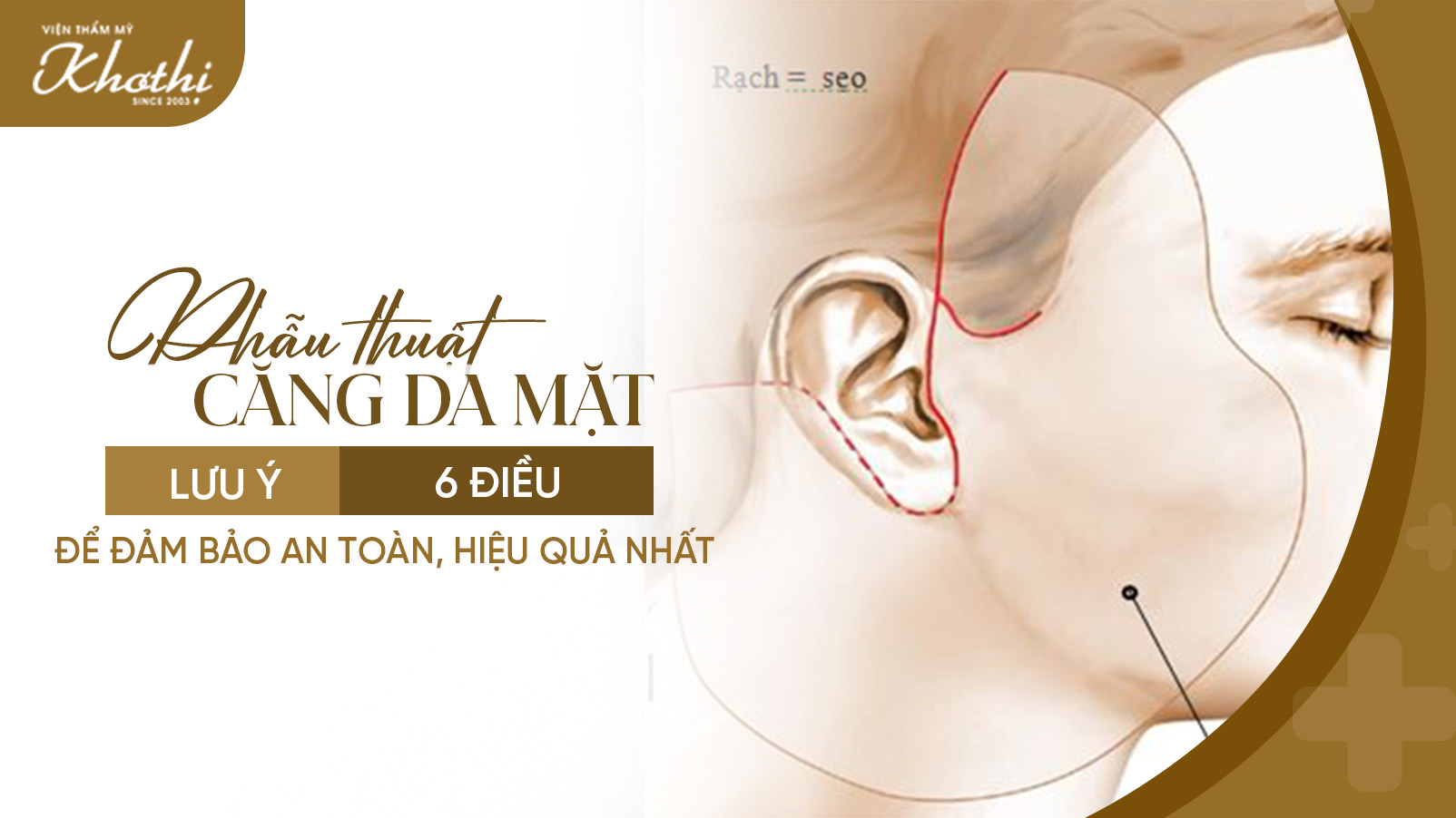 Phẫu thuật căng da mặt – Lưu ý 6 điều để đảm bảo an toàn, hiệu quả nhất