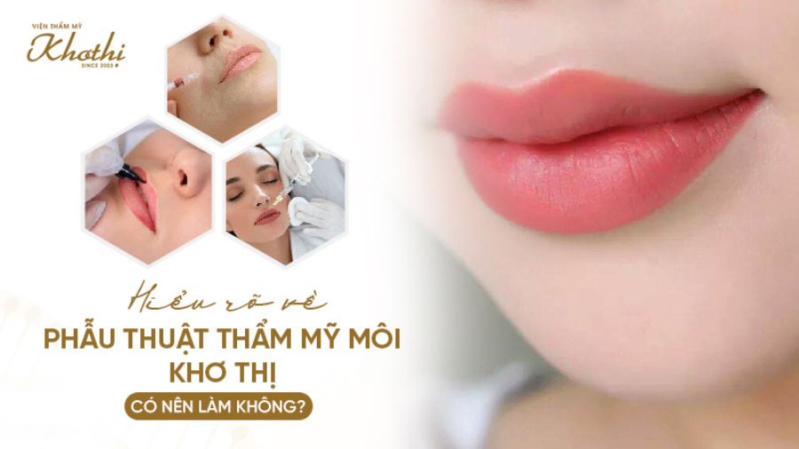 Hiểu rõ về phẫu thuật thẩm mỹ môi Khơ Thị, có nên làm không?