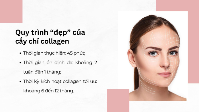 [Tư vấn] Cấy chỉ collagen được bao lâu? Có đúng là 24 tháng?