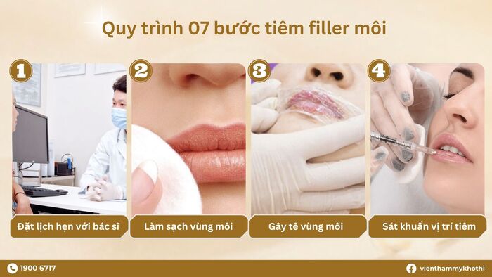Cách tiêm filler môi: 07 bước thực hiện chuẩn Y khoa