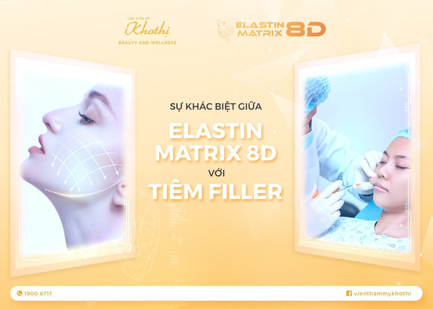 Sự Khác Biệt Chính Giữa Elastin Matrix 8D Và Tiêm Filler