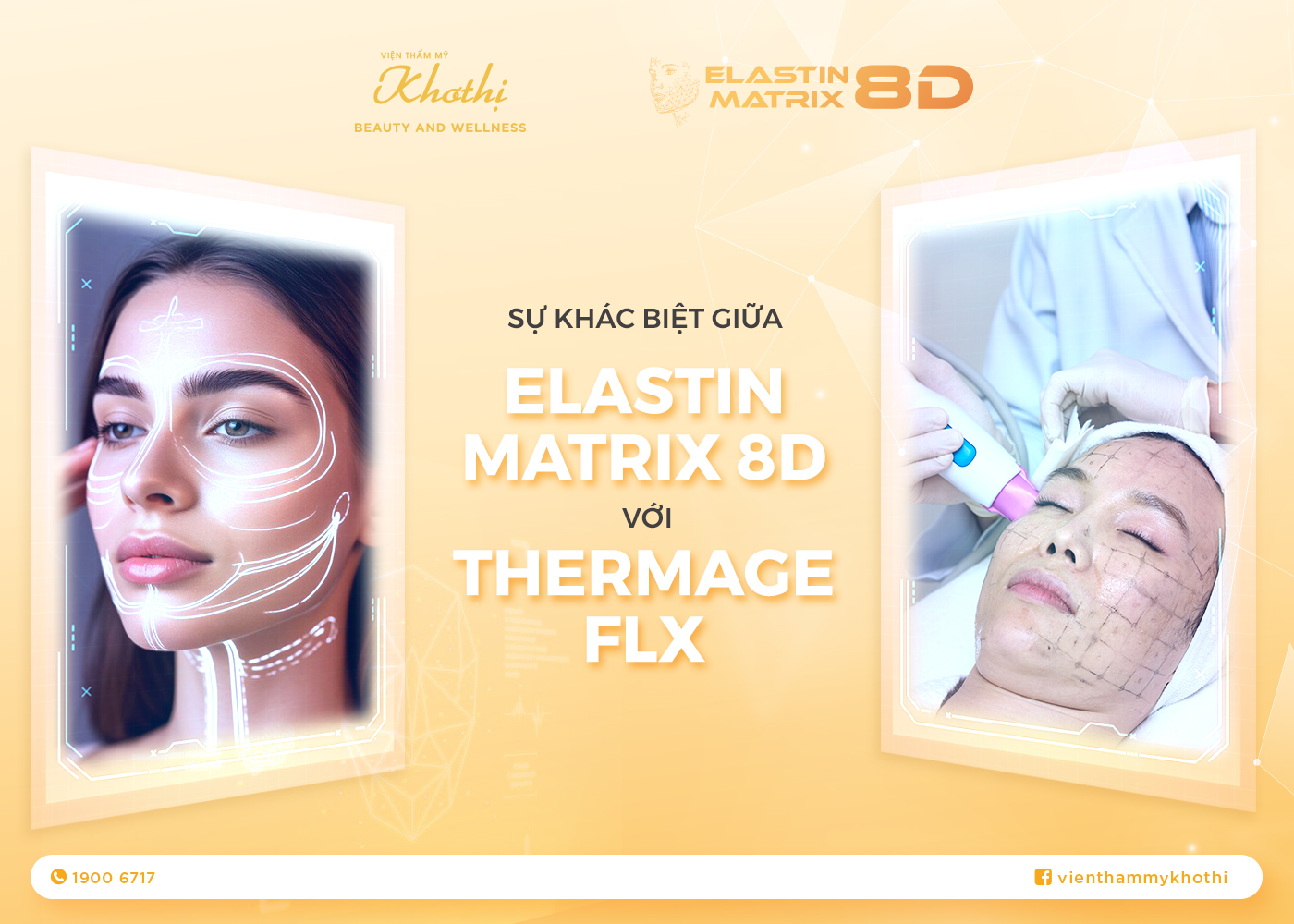 Sự Khác Biệt Giữa Elastin Matrix 8D Và Thermage FLX