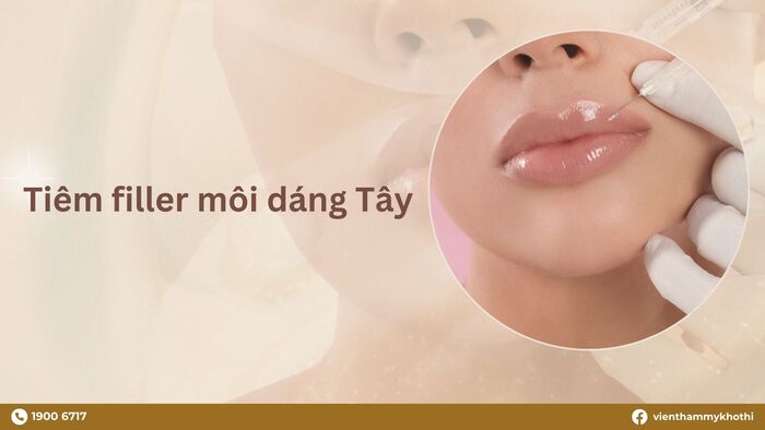 Có nên tiêm môi dáng Tây? 6 Dáng môi Tây đẹp nhất & Review thực tế