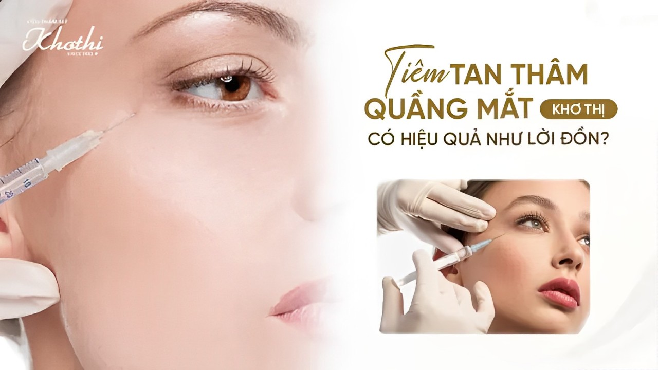 Tiêm tan thâm quầng mắt Khơ Thị có hiệu quả như lời đồn?