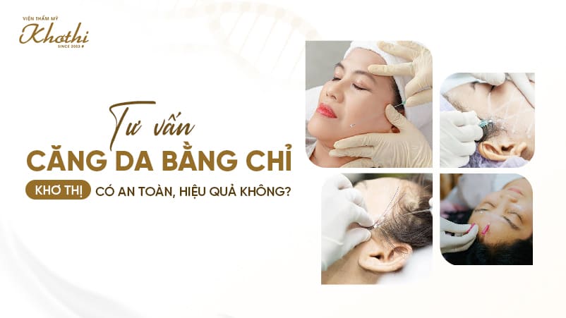 Tư vấn căng da bằng chỉ Khơ Thị có an toàn, hiệu quả không?