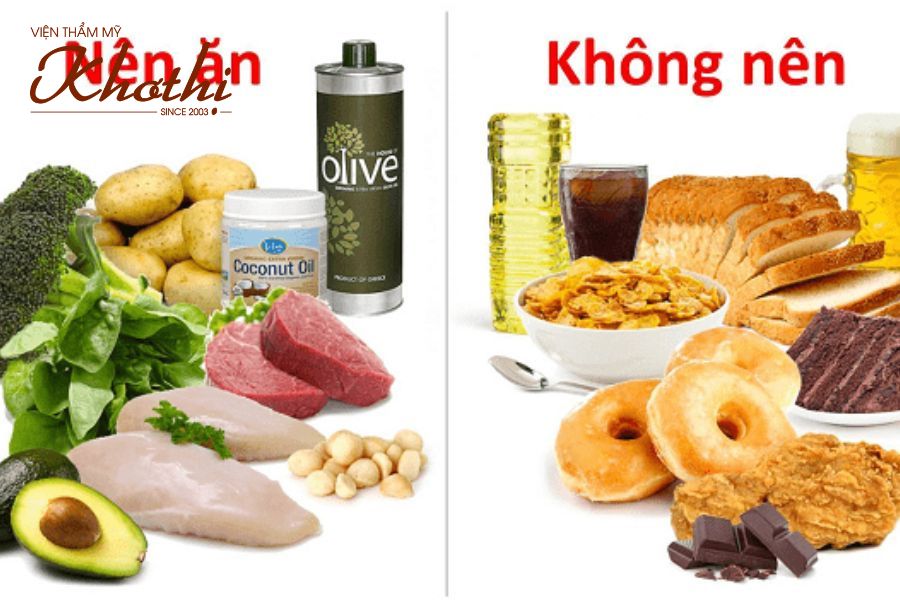 Bổ sung ăn rau xanh, hạn chế tinh bột để quá trình giảm cân hiệu quả