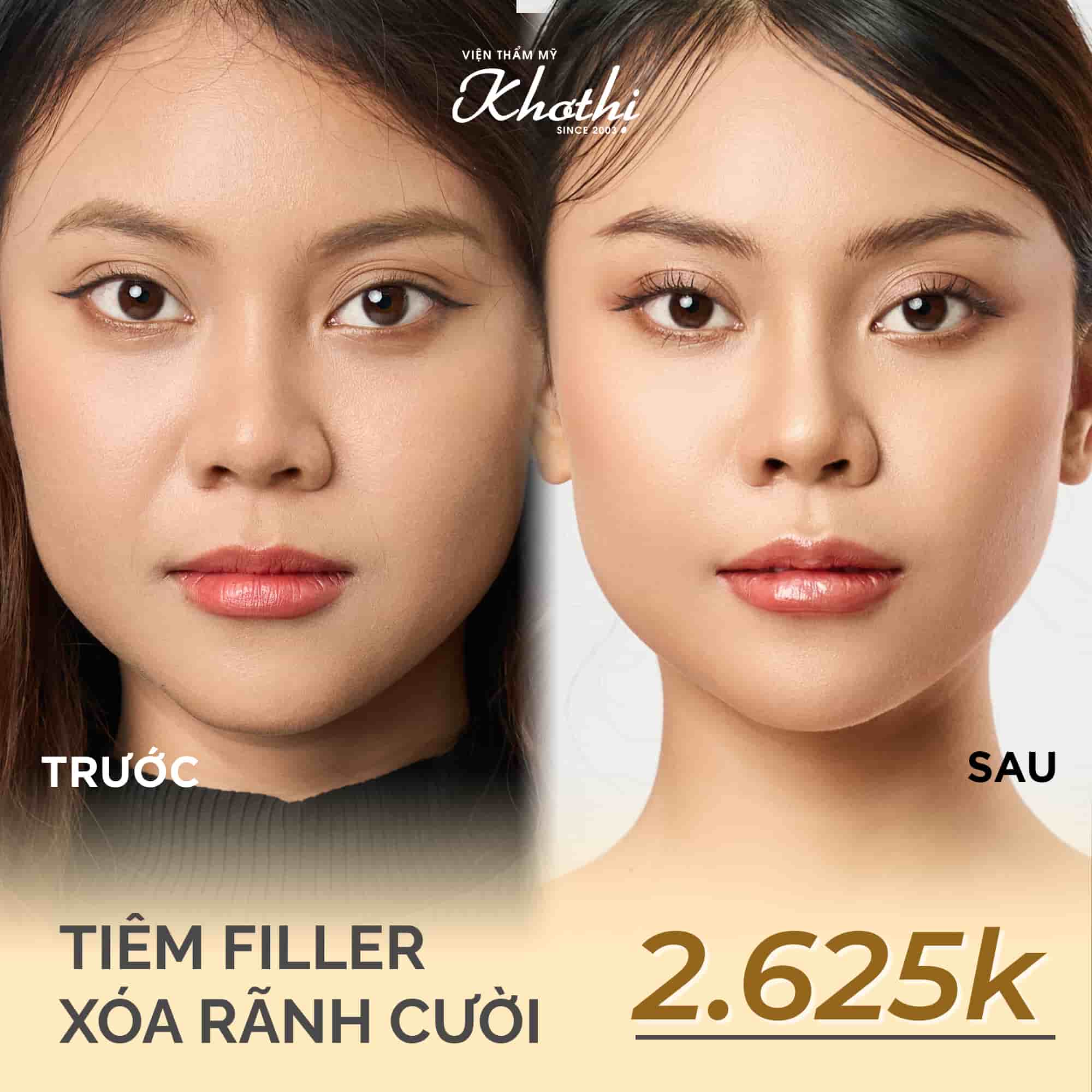 Liên hệ để có bảng giá Thẩm mỹ viện Khơ Thị chính xác của dịch vụ thẩm mỹ nội khoa