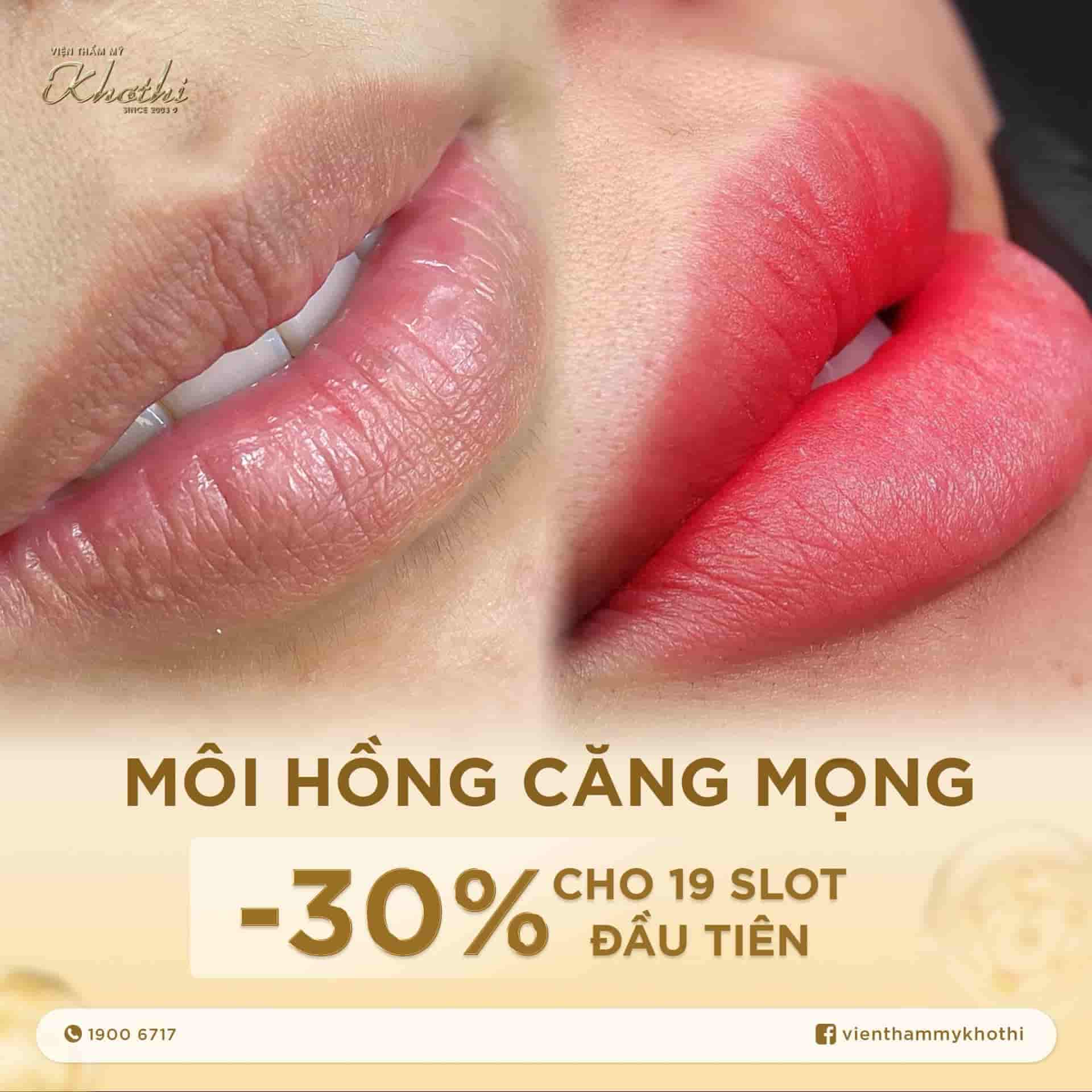 Công nghệ phun môi TINT LIPS Khơ Thị