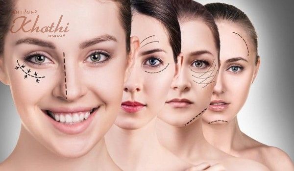 cách nâng cơ mặt không xâm lấn hiệu quả, chi phí thấp