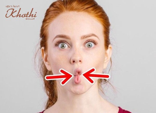Cách tập cơ mặt thon gọn với bài tập hóp má