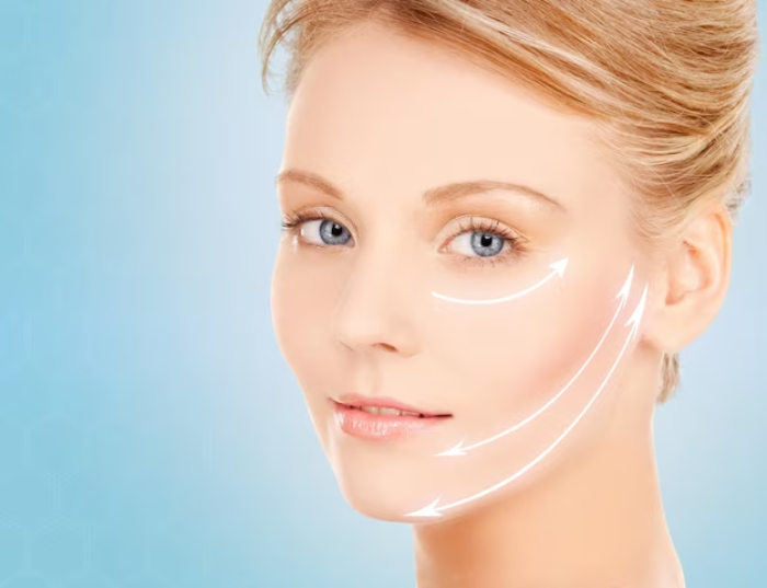 Căng chỉ collagen rất an toàn, ít xâm lấn