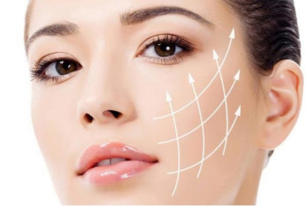 Căng da mặt bằng chỉ collagen giúp kéo căng nhóm cơ dưới mắt