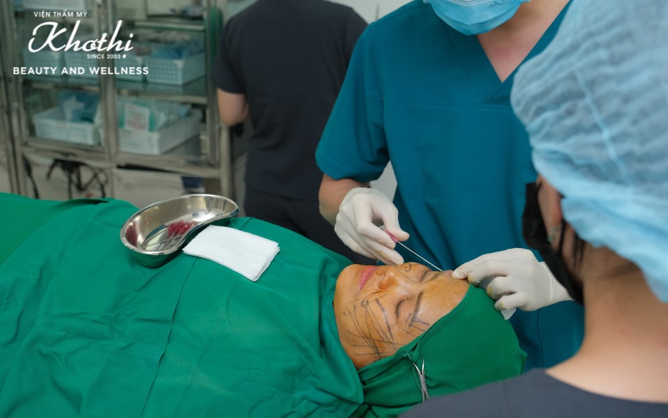 căng chỉ collagen