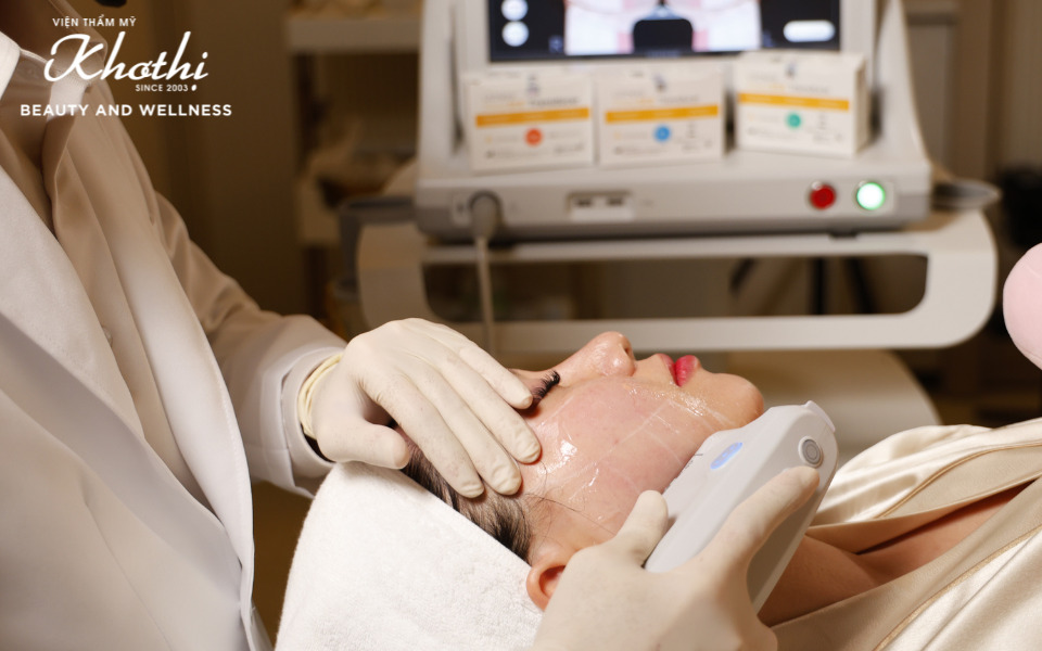 căng da mặt ultherapy