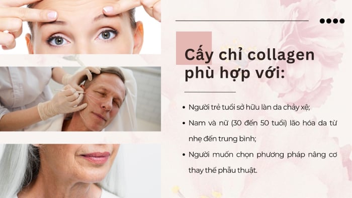 07 yếu tố ảnh hưởng đến thời gian hiệu quả của cấy chỉ collagen.