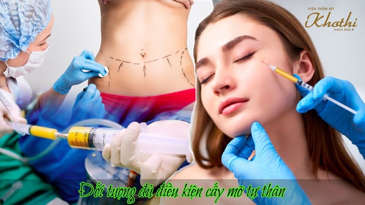 cấy mỡ mặt