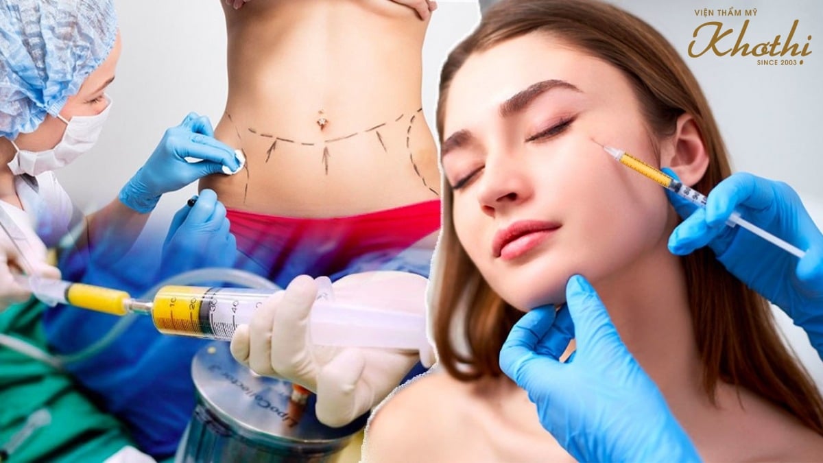 cấy mỡ tự thân