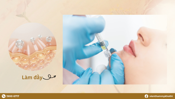 Chất làm đầy nằm ở lớp thượng bị của vùng da cằm, giúp cằm trông đầy đặn và săn chắc