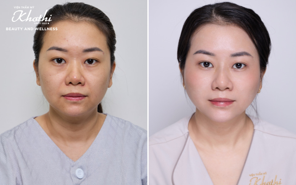 chỉ pdo là gì