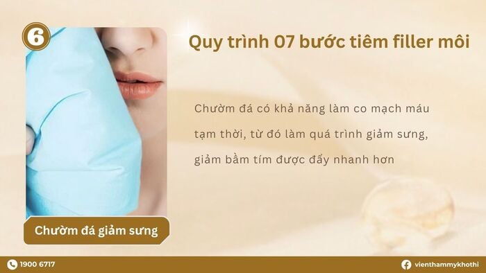 Chườm đá vào vị trí tiêm filler giúp giảm sưng viêm, bầm tím sau khi thực hiện tiêm filler