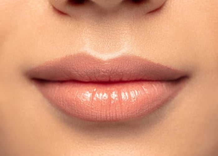 Chườm nóng làm tan filler môi nhanh chóng.