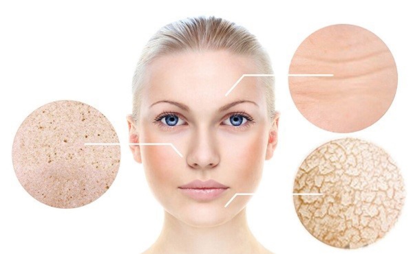 Biểu hiện của làn da bị lão hóa