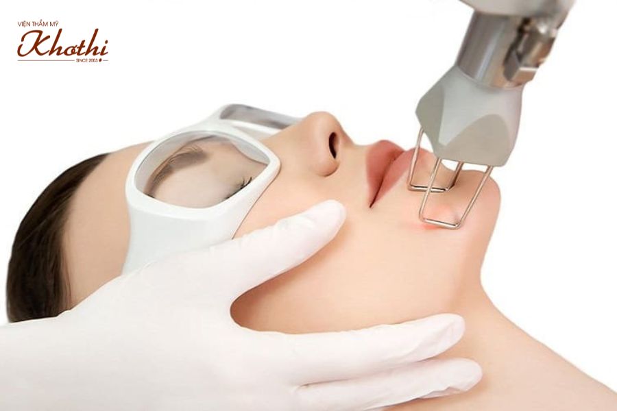 Công nghệ điều trị sẹo Khơ Thị