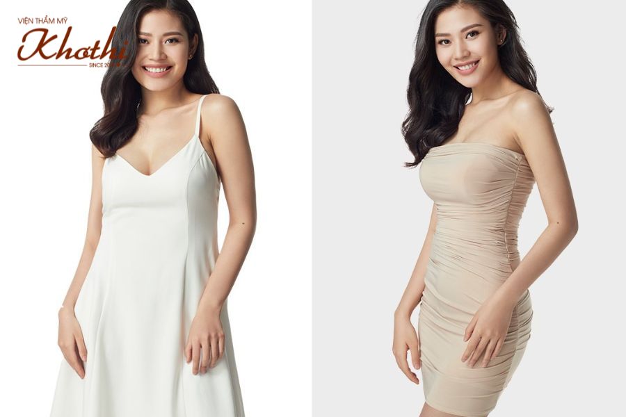 Vóc dáng của Chúng Huyền Thanh bà mẹ 2 con sau sinh khi sử dụng Miko Diet