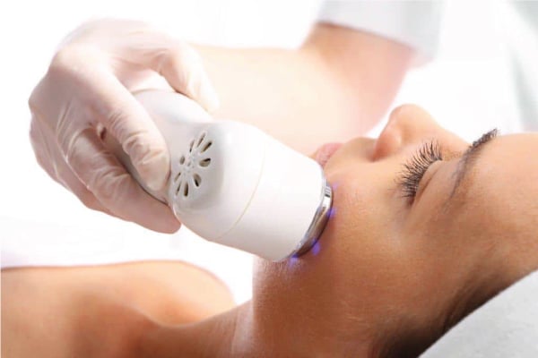 Công nghệ RF giúp nâng cơ hiện đại