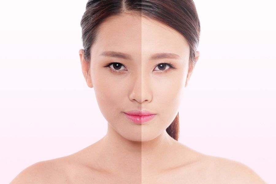 Công nghệ tắm trắng Khơ Thị