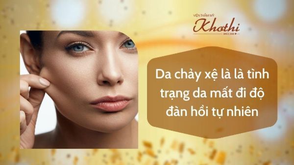 Da chảy xệ là tình trạng da mất đi độ đàn hồi tự nhiên Da chảy xệ là tình trạng da mất đi độ đàn hồi tự nhiên