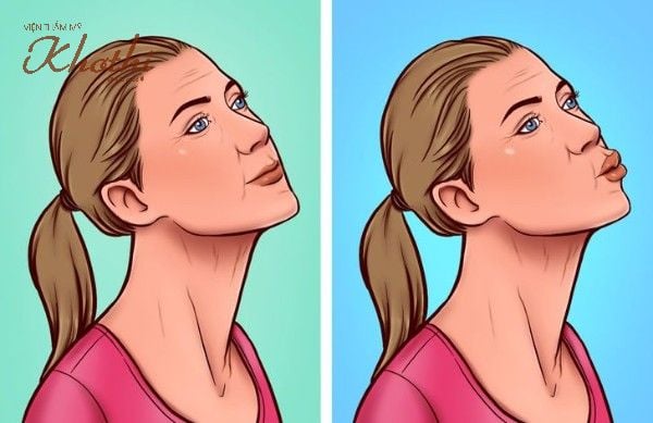 Bài tập nụ hôn giúp xóa nếp nhăn vùng da cổ