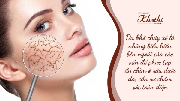 Da khô chảy xệ cần sự chăm sóc toàn diện.