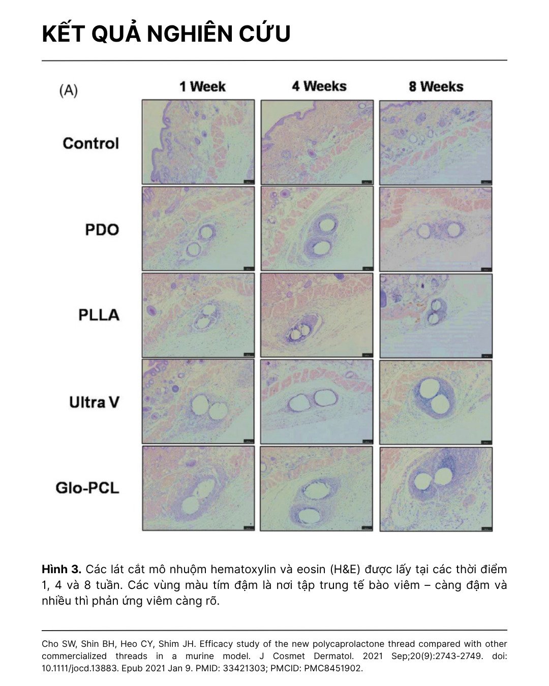 hiệu quả của chỉ pcl