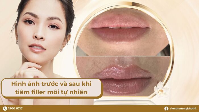 Tạo hình môi làm dáng môi đẹp tự nhiên, nâng cấp nhan sắc