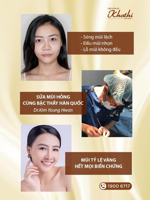 Lương ngọc ảnh sửa mũi biến chứng tại Khơ Thị