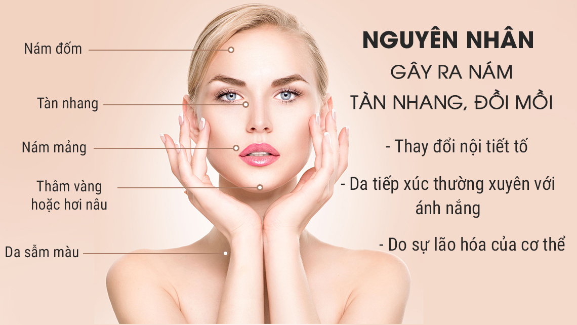 Tổng hợp toàn bộ những kiến thức điều trị nám bạn cần biết