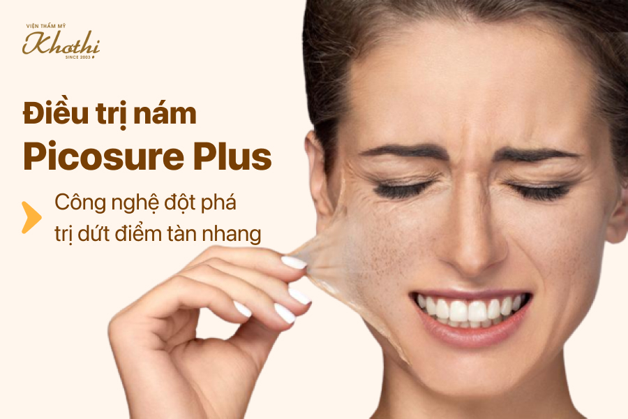 ĐIỀU TRỊ NÁM PICOSURE PLUS – CÔNG NGHỆ ĐỘT PHÁ TRỊ DỨT ĐIỂM NÁM