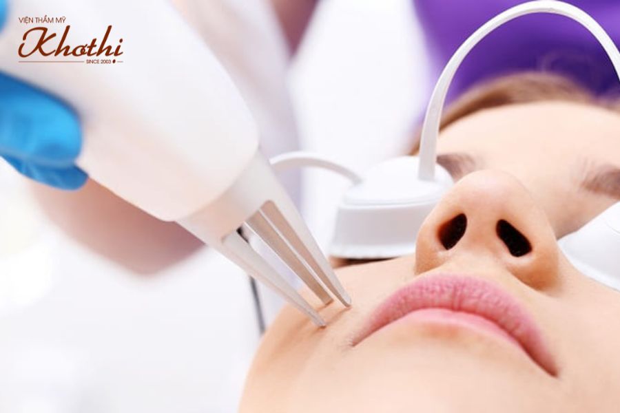 Các phương pháp điều trị sẹo hiệu quả