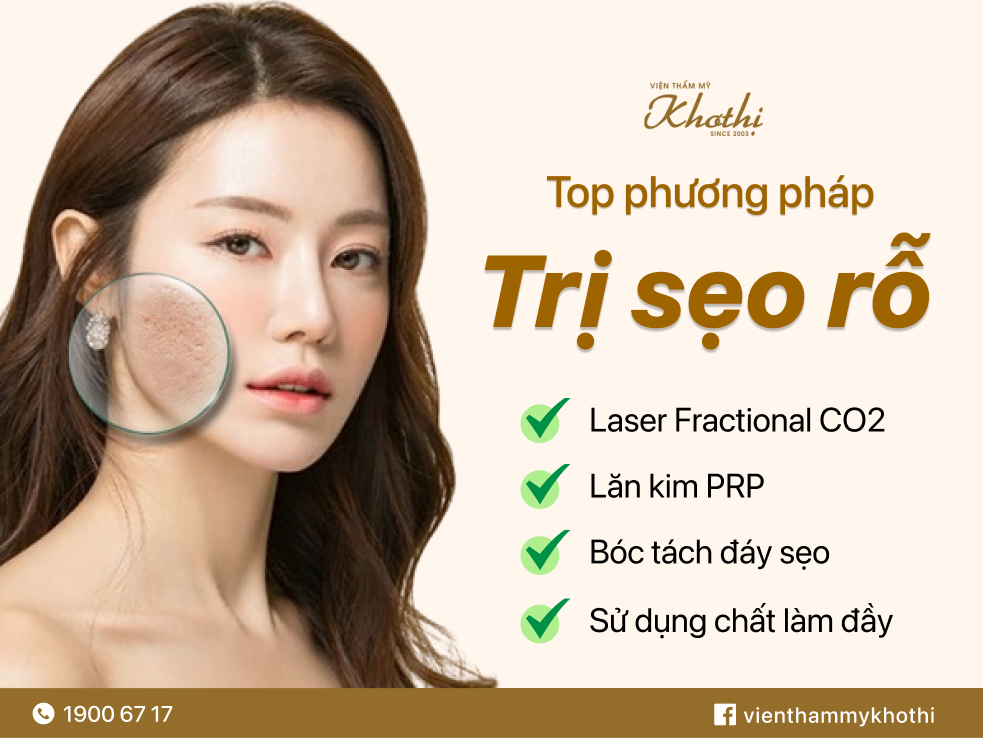 Những phương pháp trị sẹo rỗ tốt nhất hiện nay
